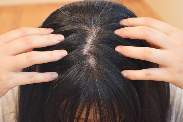 毛を抜く癖を解消する対処方法や対策・原因・特徴について